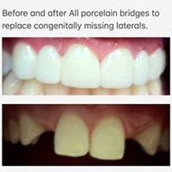 Silver Firs Family & Implant Dentistry