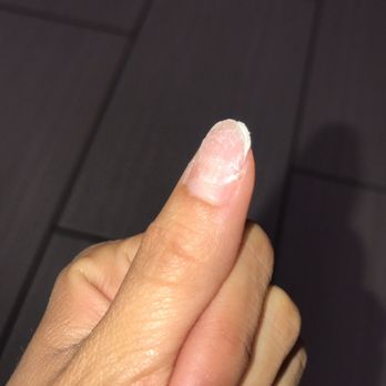 Fresh Nails & Spa - Pulled a lot of my natural nail on the side causing it to burn when acrylic was being applied - Nail Salons Near Me - Glendale, Arizona Fresh Nails & Spa - Pulled a lot of my natural nail on the side causing it to burn when acrylic was being applied - Nail Salons Near Me - Glendale, Arizona