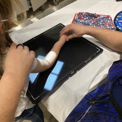 Deaconess North Emergency Center - Broken arm