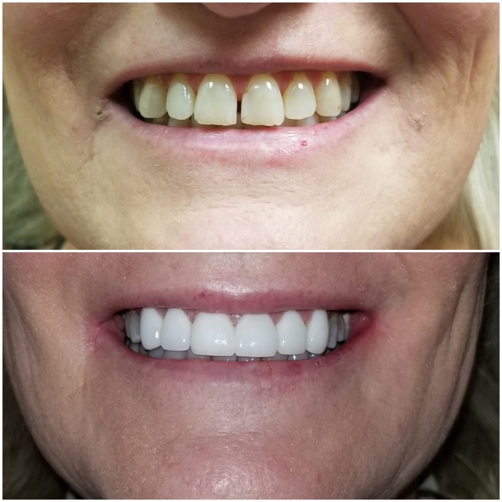 SIERRA DENTAL CARE 16 Photos & 68 Reviews General Dentistry 19223