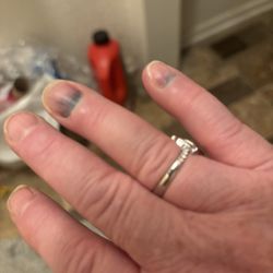 Fingers that got slammed in restroom door does