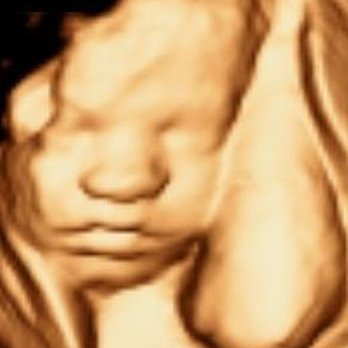 My Little Bean 4D - Diagnostic Imaging Near Me - Greenwood, South Carolina My Little Bean 4D - Diagnostic Imaging Near Me - Greenwood, South Carolina