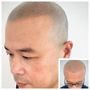 Photo of Precision Scalp Micropigmentation