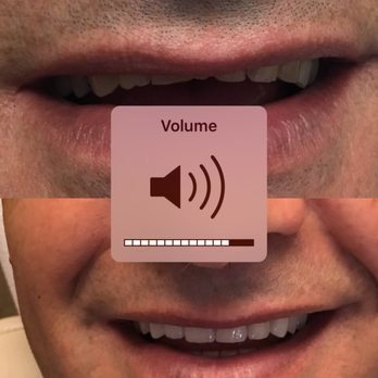 Hamlet Davari, DDS - Oral Surgeons Near Me - Glendale, California Hamlet Davari, DDS - Oral Surgeons Near Me - Glendale, California