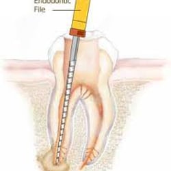 Tayler, Robert - Practice limited to Endodontics. Please call to make an appointment.