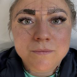 Rewind Aesthetics, Dermatology, and Trichology - Being marked for my eyebrows
