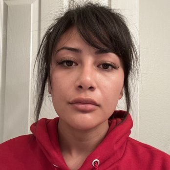 Ageless MD - No makeup! Skin is tighter/lifted and soo much clearer after one session of Sylfirm. Mad I didn't do undereye fillers sooner lol - Medical Spas Near Me - Tustin, California Ageless MD - No makeup! Skin is tighter/lifted and soo much clearer after one session of Sylfirm. Mad I didn't do undereye fillers sooner lol - Medical Spas Near Me - Tustin, California
