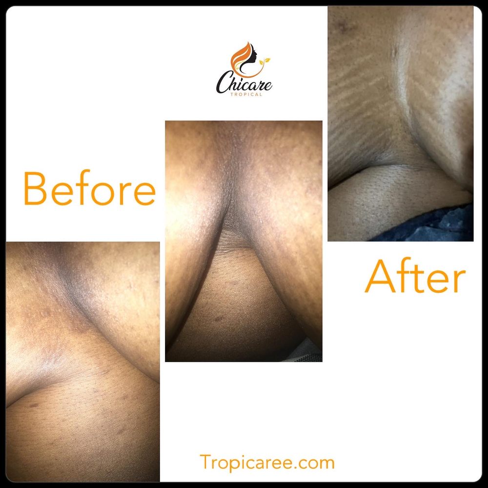Chicare Tropical Logo