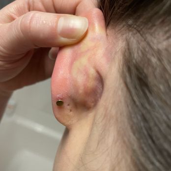 Official Ink Tattoo - Incorrect placement of the piercing channel - Tattoo Near Me - Philadelphia, Pennsylvania Official Ink Tattoo - Incorrect placement of the piercing channel - Tattoo Near Me - Philadelphia, Pennsylvania