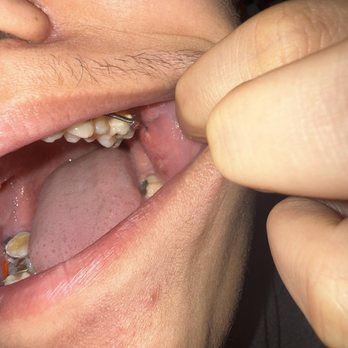 Christopher H Nguyen, DMD, MSD - Orthodontists Near Me - Santa Ana, California Christopher H Nguyen, DMD, MSD - Orthodontists Near Me - Santa Ana, California
