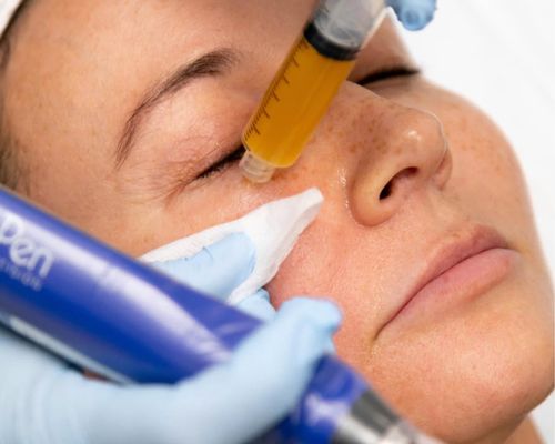 b12 injection los angeles TOP 10 BEST B12 Injections in Los Angeles, CA - Updated 2026 - Quality &  Affordability