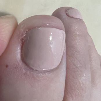 Allure Nails & Spa - He cut me during pedicure . Today I can't wear closed toes shoes it hurts so much . - Nail Salons Near Me - Coral Springs, Florida Allure Nails & Spa - He cut me during pedicure . Today I can't wear closed toes shoes it hurts so much . - Nail Salons Near Me - Coral Springs, Florida
