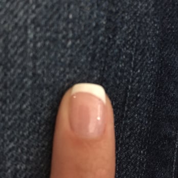 Diva Nail Spa - Uneven smile lines - Nail Salons Near Me - Ann Arbor, Michigan Diva Nail Spa - Uneven smile lines - Nail Salons Near Me - Ann Arbor, Michigan