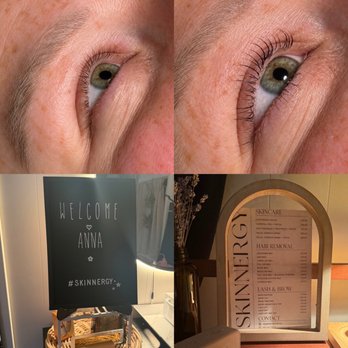 Skinnergy Aesthetics - Estheticians Near Me Skinnergy Aesthetics - Estheticians Near Me