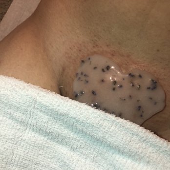bare skin - Post Brazilian wax, calming the skin with a jelly mask! - Waxing Near Me - Turlock, California bare skin - Post Brazilian wax, calming the skin with a jelly mask! - Waxing Near Me - Turlock, California