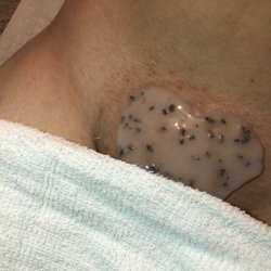 Post Brazilian wax, calming the skin with a jelly mask!