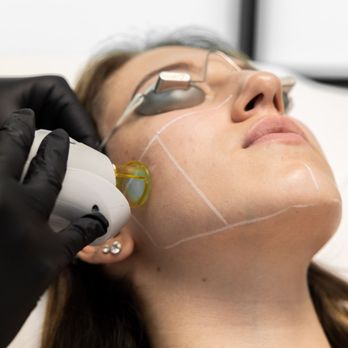Skin - Laser hair removal in Las Vegas for a women's full face is $55 per session. - Skin Care Near Me - Las Vegas, Nevada Skin - Laser hair removal in Las Vegas for a women's full face is $55 per session. - Skin Care Near Me - Las Vegas, Nevada