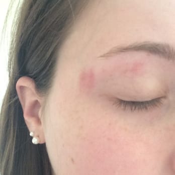 Nails By Pro - Eyebrow burns - Nail Salons Near Me - Austin, Texas