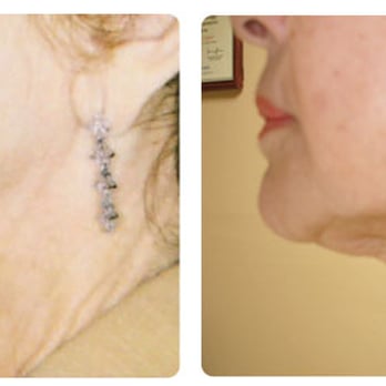 UltiSkin - Medical Spas Near Me - Santa Fe, New Mexico