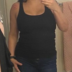 W. Tracy Hankins, MD - FEB 20, 2021
11 WEEKS POST-OP