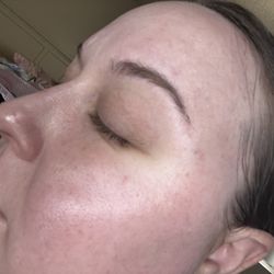 MIS Eyebrow Threading