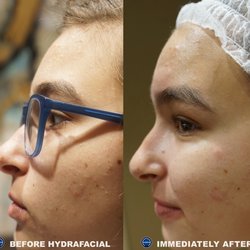 Flawless Laser & Med Spa - Clear Skin Instantly.