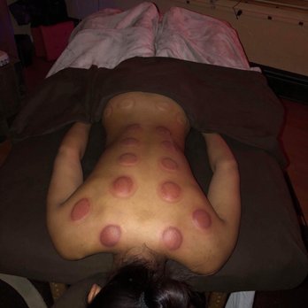 Be Authentic by Gio - So happy everything got sucked out! It looks weird but the feeling is Insanely AMAZING !! - Massage Therapy Near Me - Tiverton , Rhode Island