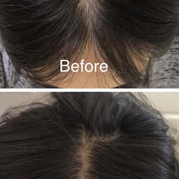 Beautify By Karin - PRP for Hair Regrowth - Medical Spas Near Me - Glendale, California