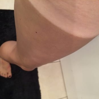 Royal Aesthetics - After one spray tan - Spray Tanning Near Me - Brentwood, California Royal Aesthetics - After one spray tan - Spray Tanning Near Me - Brentwood, California