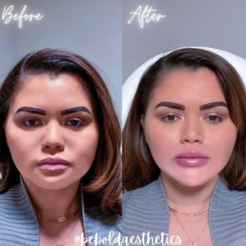 Bebold Aesthetics - Aestheticians Near Me - Rockville, Maryland Bebold Aesthetics - Aestheticians Near Me - Rockville, Maryland