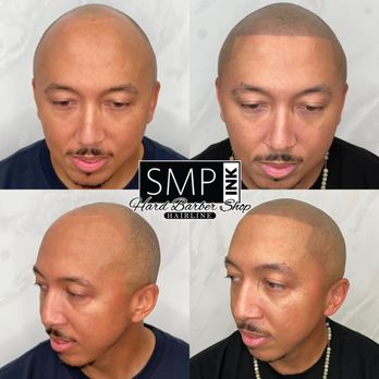 SMP INK - Hair Loss Centers Near Me - Las Vegas, Nevada SMP INK - Hair Loss Centers Near Me - Las Vegas, Nevada