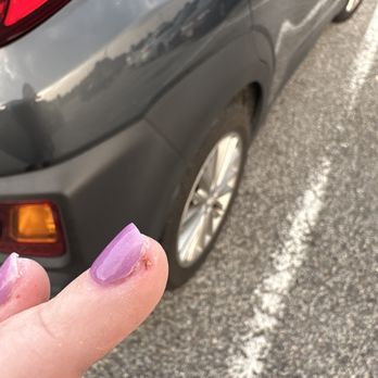 Fashion Nails - Uneven nails and cuts around the edges of my fingers - Nail Salons Near Me - Colonial Heights, Virginia Fashion Nails - Uneven nails and cuts around the edges of my fingers - Nail Salons Near Me - Colonial Heights, Virginia