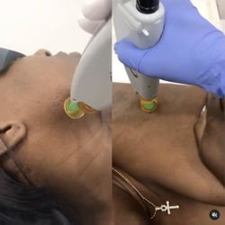 Natural Radiance Spa - Laser hair removal