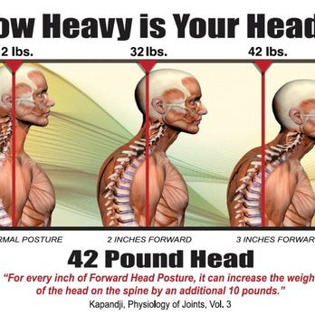 Martin K Bates,DC - Effects of computer posture on your neck and shoulders... we can help! - Chiropractors Near Me - Fremont, California Martin K Bates,DC - Effects of computer posture on your neck and shoulders... we can help! - Chiropractors Near Me - Fremont, California