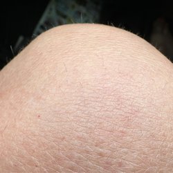 The Face and The Body Spa & Salon - Terrible results after 10+ treatments on light skin w/dark, coarse hair. They use cheap, ineffective machines.