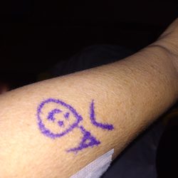 Antario Joseph MD Facs - Dr Stamp before a surgery . :)