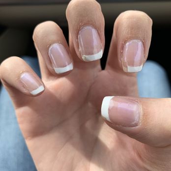 Perfect Nails Salon & Spa - Chipped nails and broken skin around cuticles from manicurist - Nail Salons Near Me - Puyallup, Washington Perfect Nails Salon & Spa - Chipped nails and broken skin around cuticles from manicurist - Nail Salons Near Me - Puyallup, Washington
