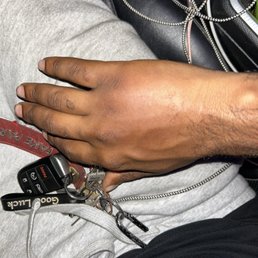 How bad my hand was that day
