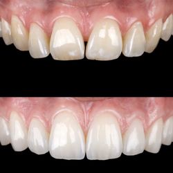 Bayshore Dental