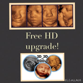 3D Maternity Imaging - Diagnostic Imaging Near Me - New Hyde Park, New York 3D Maternity Imaging - Diagnostic Imaging Near Me - New Hyde Park, New York