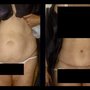 Mark I Silberman, MD - The Plastic Surgery Group