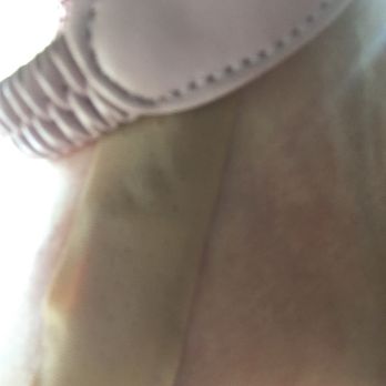 Luxe Nail Bar - My very bad cut. - Nail Salons Near Me - Tulsa, Oklahoma