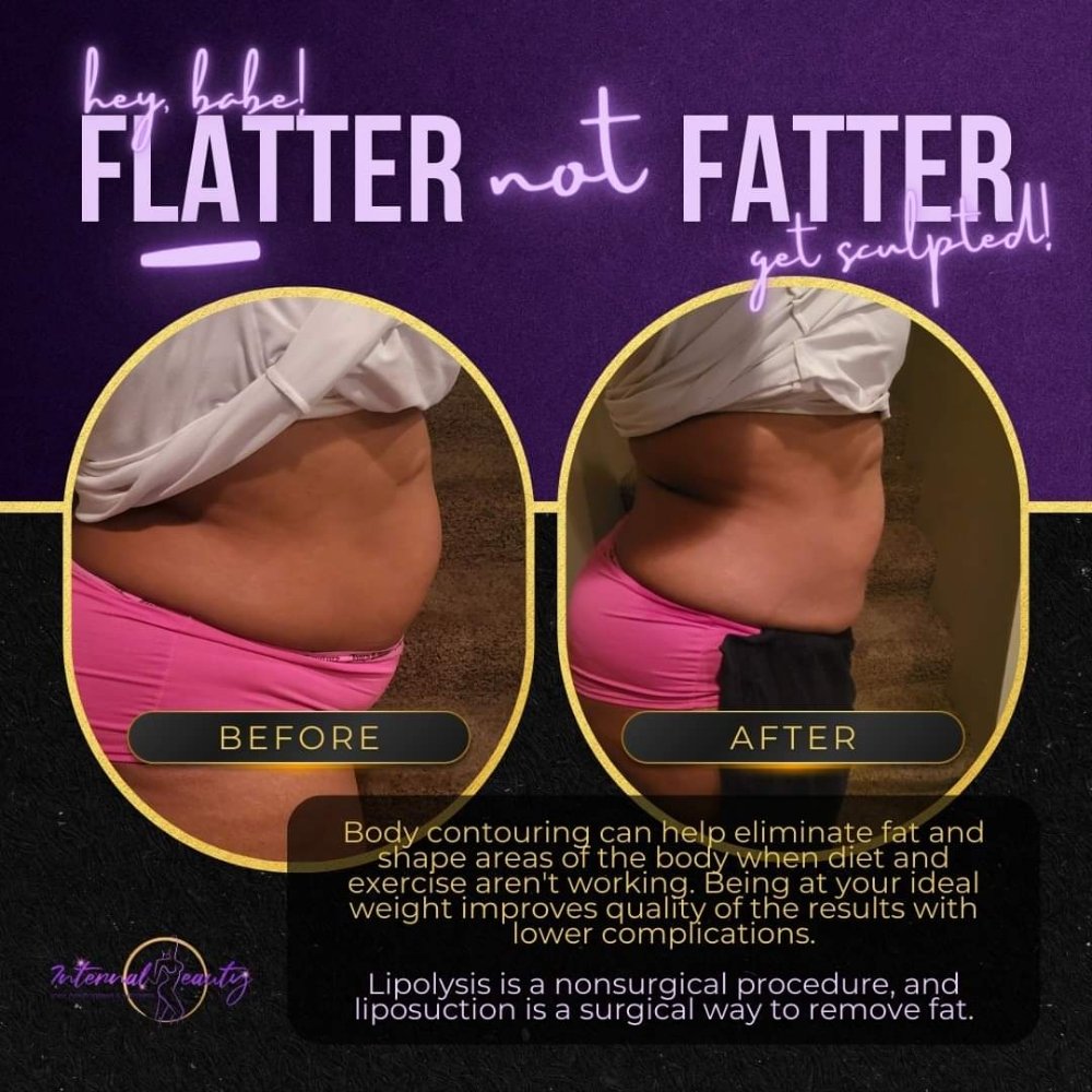 Internal Beauties Body Contouring & Wellness Logo
