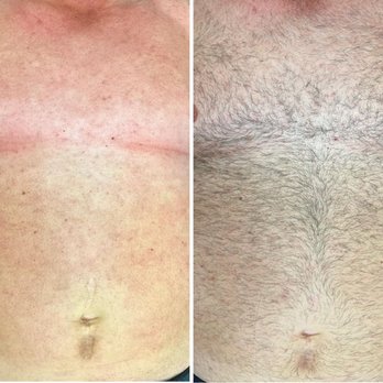 The Groovy Glow - Mens Full Chest & Full Stomach Wax - Waxing Near Me - Scottsdale, Arizona The Groovy Glow - Mens Full Chest & Full Stomach Wax - Waxing Near Me - Scottsdale, Arizona