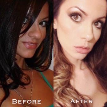 John Minoli MD FACS Las Vegas Cosmetic Surgery - Before and Afters of my rhinoplasty. Amazing work by Dr. Minoli! This man is a genius with the skills of a fine artist! - Cosmetic Surgeons Near Me - Las Vegas, Nevada John Minoli MD FACS Las Vegas Cosmetic Surgery - Before and Afters of my rhinoplasty. Amazing work by Dr. Minoli! This man is a genius with the skills of a fine artist! - Cosmetic Surgeons Near Me - Las Vegas, Nevada