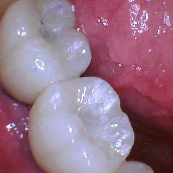 American Dental Group - Tooth implants - General Dentistry Near Me - West Covina, California American Dental Group - Tooth implants - General Dentistry Near Me - West Covina, California