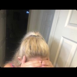 Discoloration