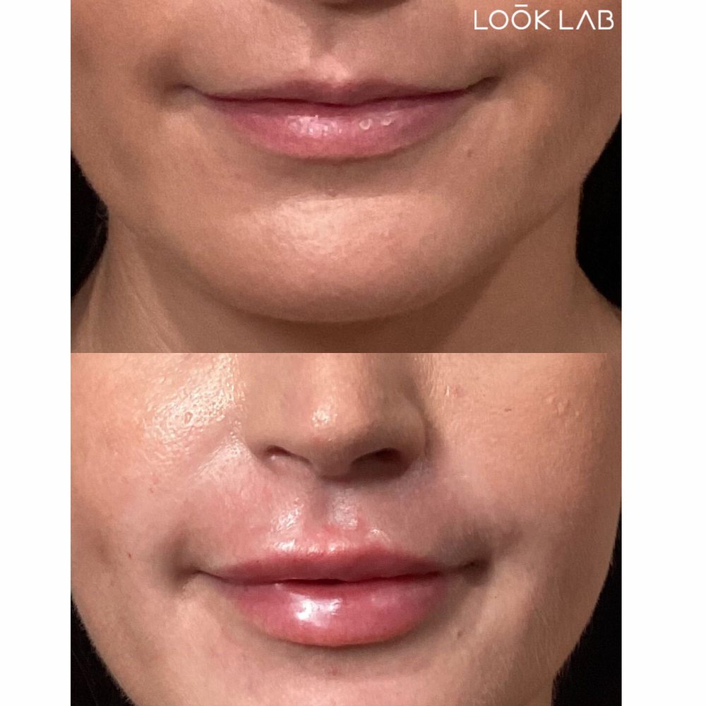 LOOK LAB MED SPA 27 Photos 3545 E Indian School Rd, Phoenix