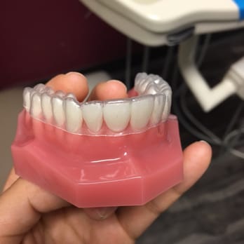 Divine Dental Spa - Clear braces - Cosmetic Dentists Near Me - El Paso, Texas Divine Dental Spa - Clear braces - Cosmetic Dentists Near Me - El Paso, Texas