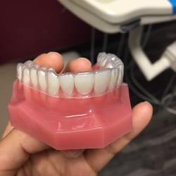 Divine Dental Spa - Clear braces